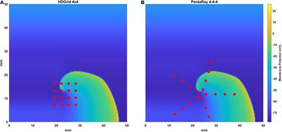 Computational Analysis of Mapping Catheter Geometry and Contact Quality Effects on Rotor Detection in Atrial Fibrillation